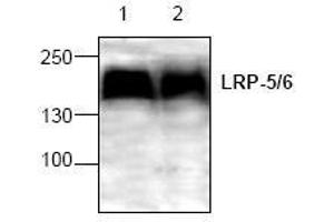 Image no. 1 for anti-Low Density Lipoprotein Receptor-Related Protein 5 (LRP5) antibody (ABIN127323) (LRP5 Antikörper)
