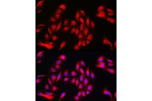 Immunofluorescence analysis of U2OS cells using Annexin  Rabbit pAb (ABIN6127436, ABIN6136920, ABIN6136921 and ABIN6223291) at dilution of 1:50 (40x lens). (Annexin A11 Antikörper  (AA 276-505))