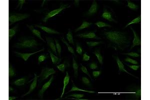 Immunofluorescence of monoclonal antibody to IFT20 on HeLa cell. (IFT20 Antikörper  (AA 1-148))