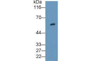 Detection of PKBb in Rat Thyroid lysate using Polyclonal Antibody to Protein Kinase B Beta (PKBb) (AKT2 Antikörper  (AA 142-412))