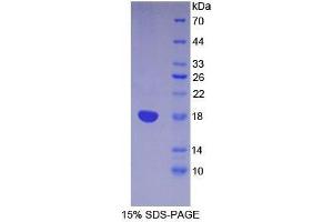 SDS-PAGE analysis of Mouse Lymphocyte Antigen 96 Protein. (LY96 Protein)