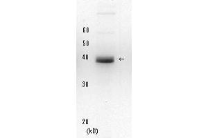 Western Blotting (WB) image for anti-Xeroderma Pigmentosum, Complementation Group A (XPA) (full length) antibody (ABIN3200998) (XPA Antikörper  (full length))