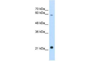 WB Suggested Anti-RBPJL Antibody Titration:  2. (RBPJL Antikörper  (N-Term))