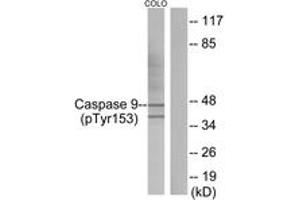 Western blot analysis of extracts from COLO205 cells, using Caspase 9 (Phospho-Tyr153) Antibody. (Caspase 9 Antikörper  (pTyr153))