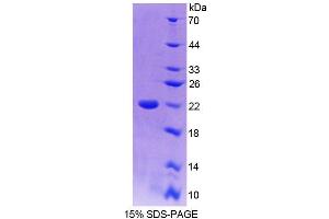 SDS-PAGE analysis of Mouse TRERF1 Protein. (TRERF1 Protein)