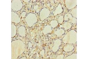 Immunohistochemistry of paraffin-embedded human thyroid tissue using ABIN7154959 at dilution of 1:100 (HEBP2 Antikörper  (AA 2-205))