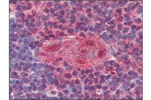 Immunohistochemistry (IHC) image for anti-Uracil-DNA Glycosylase (UNG) (AA 1-313), (N-Term) antibody (ABIN317576) (UNG Antikörper  (N-Term))