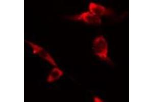 ABIN6275496 staining RAW264. (ARHGEF12 Antikörper  (Internal Region))