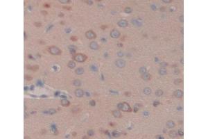 IHC-P analysis of brain tissue, with DAB staining. (GLRa2 Antikörper  (AA 28-253))