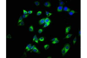 Immunofluorescence staining of HepG2 cells with ABIN7160181 at 1:200, counter-stained with DAPI. (CD14 Antikörper  (AA 20-345))