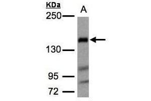 WB Image Sample(30 ug whole cell lysate) A:Raji , 5% SDS PAGE antibody diluted at 1:1000 (Flightless I Antikörper  (Internal Region))