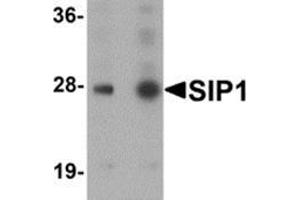 Western blot analysis of SIP1 in HeLa cell lysate with SIP1 antibody at (A) 0. (SIP1 Antikörper  (C-Term))