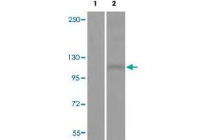 Western blot analysis of Lane 1: antigen-specific peptide treated JK cells, Lane 2: JK cells with DDR1 (phospho Y513) polyclonal antibody  at 1:500-1000 dilution. (DDR1 Antikörper  (pTyr513))