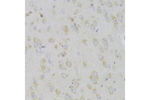 Immunohistochemistry of paraffin-embedded mouse brain using MAP2K5 Antibody (ABIN5974181) at dilution of 1/100 (40x lens).