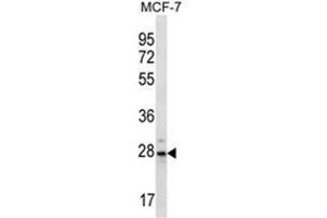 Western blot analysis of PSMB10 Antibody (C-term) in MCF-7 cell line lysates (35ug/lane). (PSMB10 Antikörper  (C-Term))