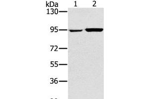 Western Blot analysis of 231 and PC3 cell using PYGL Polyclonal Antibody at dilution of 1:400 (PYGL Antikörper)