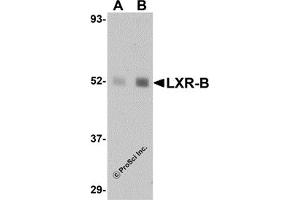 Western Blotting (WB) image for anti-Nuclear Receptor Subfamily 1, Group H, Member 2 (NR1H2) (N-Term) antibody (ABIN1031444) (NR1H2 Antikörper  (N-Term))
