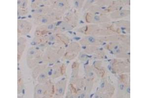 IHC-P analysis of Kidney tissue, with DAB staining. (ADCY7 Antikörper  (AA 309-491))