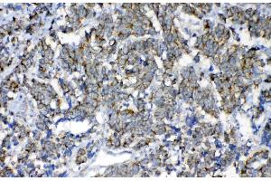 IHC analysis of FH using anti-FH antibody .