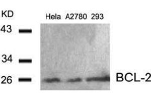 Image no. 3 for anti-B-Cell CLL/lymphoma 2 (BCL2) (AA 54-58) antibody (ABIN197202) (Bcl-2 Antikörper  (AA 54-58))
