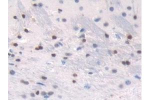 Detection of TALDO1 in Mouse Cerebrum Tissue using Polyclonal Antibody to Transaldolase (TALDO1) (TALDO1 Antikörper  (AA 35-285))