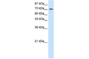 WB Suggested Anti-ZBTB48 Antibody Titration:  0.