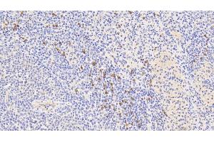 Detection of S100A9 in Human Spleen Tissue using Polyclonal Antibody to S100 Calcium Binding Protein A9 (S100A9) (S100A9 Antikörper  (AA 1-114))