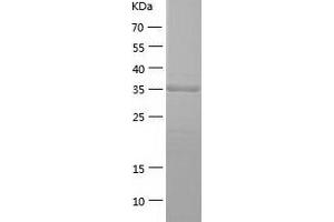 Western Blotting (WB) image for phosphoserine Aminotransferase 1 (PSAT1) (AA 1-370) protein (His tag) (ABIN7124449)