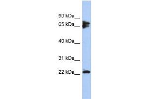 WB Suggested Anti-PPP3R1 Antibody Titration: 0. (PPP3R1 Antikörper  (N-Term))