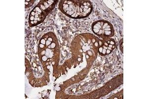 Immunohistochemical staining of human colon with MARK4 polyclonal antibody  shows moderate cytoplasmic positivity in glandular cells. (MARK4 Antikörper)