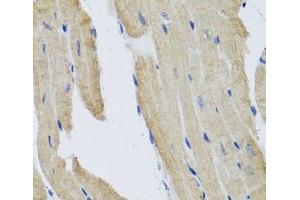Immunohistochemistry of paraffin-embedded Mouse heart using PRPH Polyclonal Antibody at dilution of 1:100 (40x lens). (Peripherin Antikörper)
