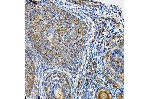 Immunohistochemistry (Paraffin-embedded Sections) (IHC (p)) image for anti-Interleukin-1 Receptor-Associated Kinase 4 (IRAK4) (AA 1-220) antibody (ABIN6142522)