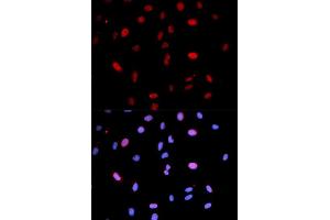 Immunofluorescence analysis of U2OS cells using Phospho-MAP2K6-S207/MAP2K3-S189 antibody (ABIN5969926). (MAP2K6 Antikörper  (pSer207))