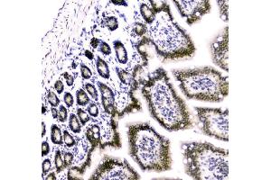 IHC analysis of Cbx8 using anti-Cbx8 antibody (ABIN7599341). (CBX8 Antikörper  (AA 1-389))