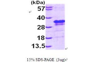 SDS-PAGE (SDS) image for Eukaryotic Translation Initiation Factor 4E (EIF4E) (AA 1-217) protein (His tag) (ABIN667809) (EIF4E Protein (AA 1-217) (His tag))