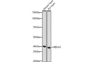 Western blot analysis of extracts of various cell lines, using PDH antibody (7432) at 1:1000 dilution. (PDHA1 Antikörper)