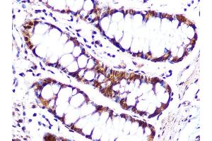 Immunohistochemistry of paraffin-embedded human colon using Cullin 4A Rabbit mAb (ABIN7266545) at dilution of 1:100 (40x lens). (Cullin 4A Antikörper)