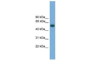 CCDC76 antibody used at 1 ug/ml to detect target protein. (CCDC76 Antikörper  (N-Term))