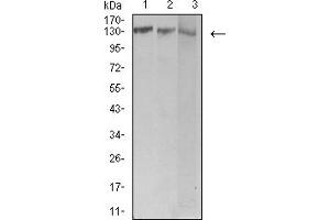 Western blot analysis using BCR mouse mAb against Jurkat (1), Hela (2), and Ramos (3) cell lysate. (BCR Antikörper  (AA 139-280))