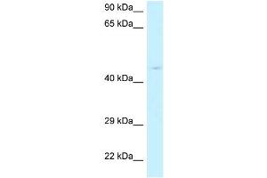 WB Suggested Anti-RPP40 Antibody Titration: 1. (RPP40 Antikörper  (N-Term))