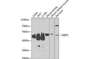 Western blot analysis of extracts of various cell lines, using  antibody (ABIN6131366, ABIN6136608, ABIN6136609 and ABIN6223268) at 1:1000 dilution. (AEBP2 Antikörper  (AA 234-503))