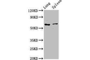 Western Blot Positive WB detected in: Rat lung tissue, Rat spleen tissue All lanes: RIPK2 antibody at 2. (RIPK2 Antikörper  (AA 1-540))