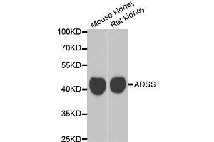 Western blot analysis of extracts of various cell lines, using GATM antibody.