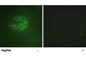 Immunofluorescence analysis of A-549 cells, using PLCB3 polyclonal antibody . (PLCB3 Antikörper)
