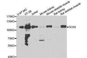 Western blot analysis of extracts of various cell lines, using SOX6 antibody. (SOX6 Antikörper  (AA 1-74))