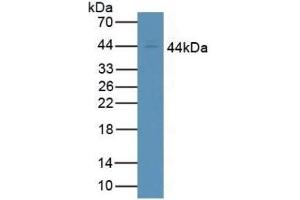 Detection of CD64 in Human Jurkat Cells using Polyclonal Antibody to Cluster Of Differentiation 64 (CD64) (FCGR1A Antikörper  (AA 73-294))