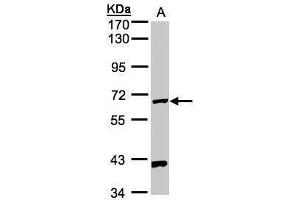 Western Blotting (WB) image for anti-Pantothenate Kinase 1 (PANK1) antibody (ABIN2856219)