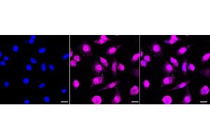 Immunocytochemical staining of HeLa cells with RAVER2 antibody (ABIN7800211), 1:1,000).