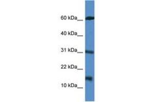 Image no. 1 for anti-Caspase Recruitment Domain Family, Member 17 (CARD17) (AA 51-100) antibody (ABIN6746959) (CARD17 Antikörper  (AA 51-100))