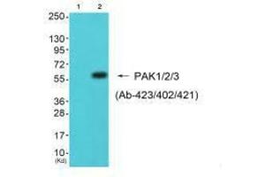 Western blot analysis of extracts from 293 cells (Lane 2), using PAK1/2/3 (Ab-423/402/421) antiobdy. (PAK1/2/3 Antikörper  (Thr402, Thr421, Thr423))